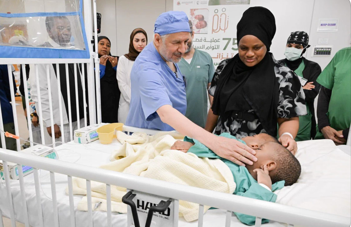 Saudi medical team undertakes complex surgery to separate Tanzanian conjoined twins — Riyadh Health news
